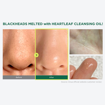 Heartleaf Pore Control Cleansing Oil (200ml)