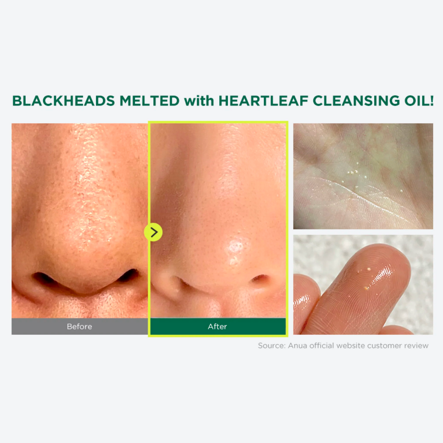 Heartleaf Pore Control Cleansing Oil Mini (20ml)
