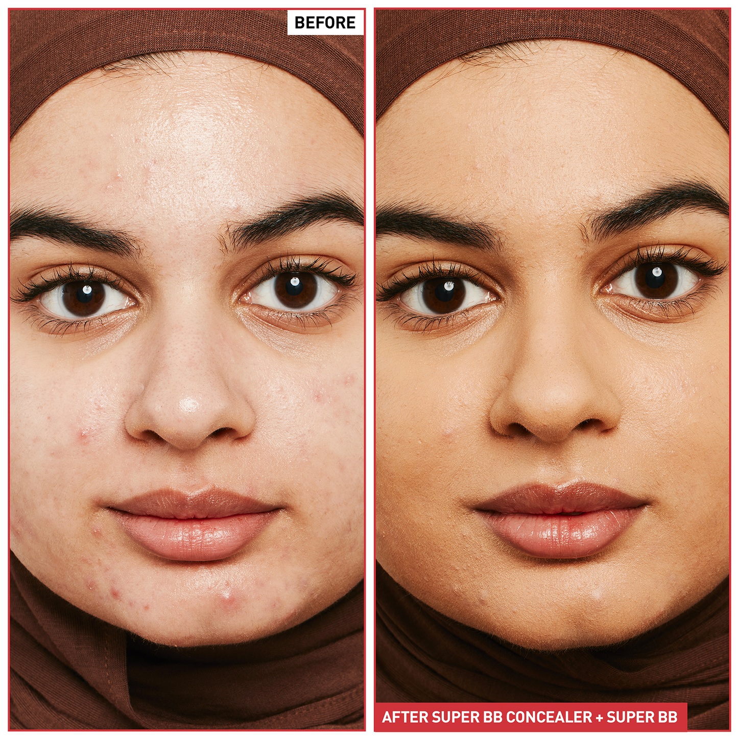 Super BB Concealer (10ml) - 5 shades