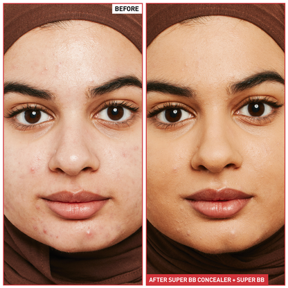 Super BB Concealer (10ml) - 5 shades